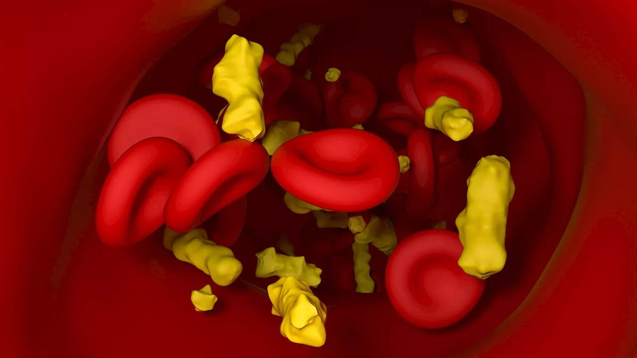 Everything you need to know about cholesterol