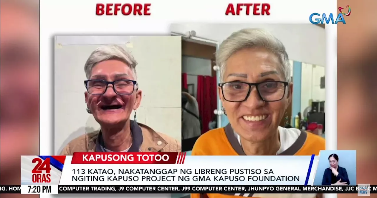 GMA Kapuso Foundation Provides Free Dentures to 113 Individuals