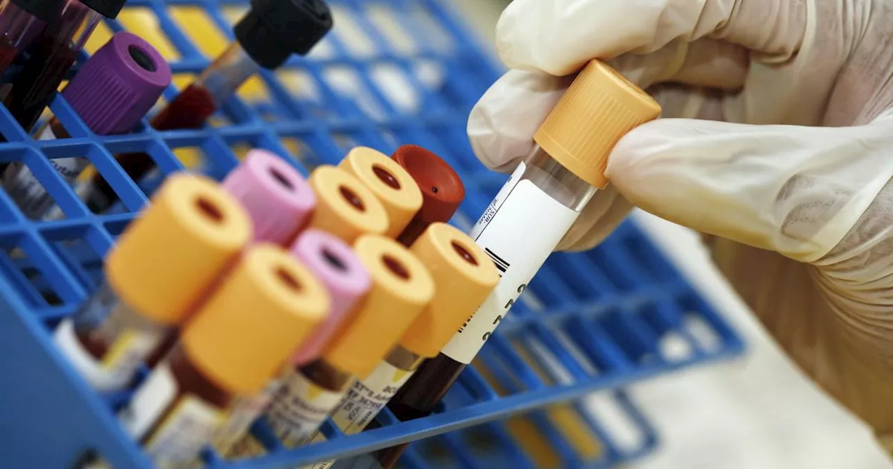 What do your blood test results mean? Here's an expert's advice on how to interpret them.