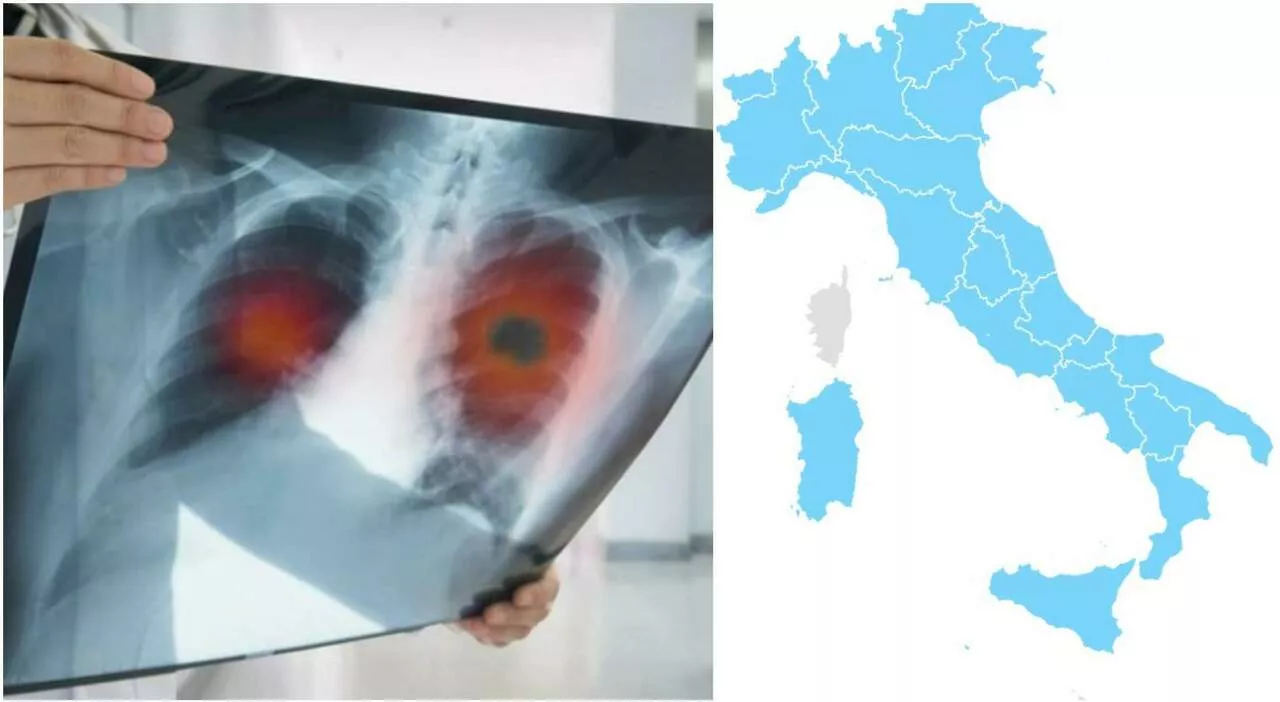 Tumori, dove curarli e quali: ecco la classifica (e la mappa) per patologie delle migliori strutture da Nord a