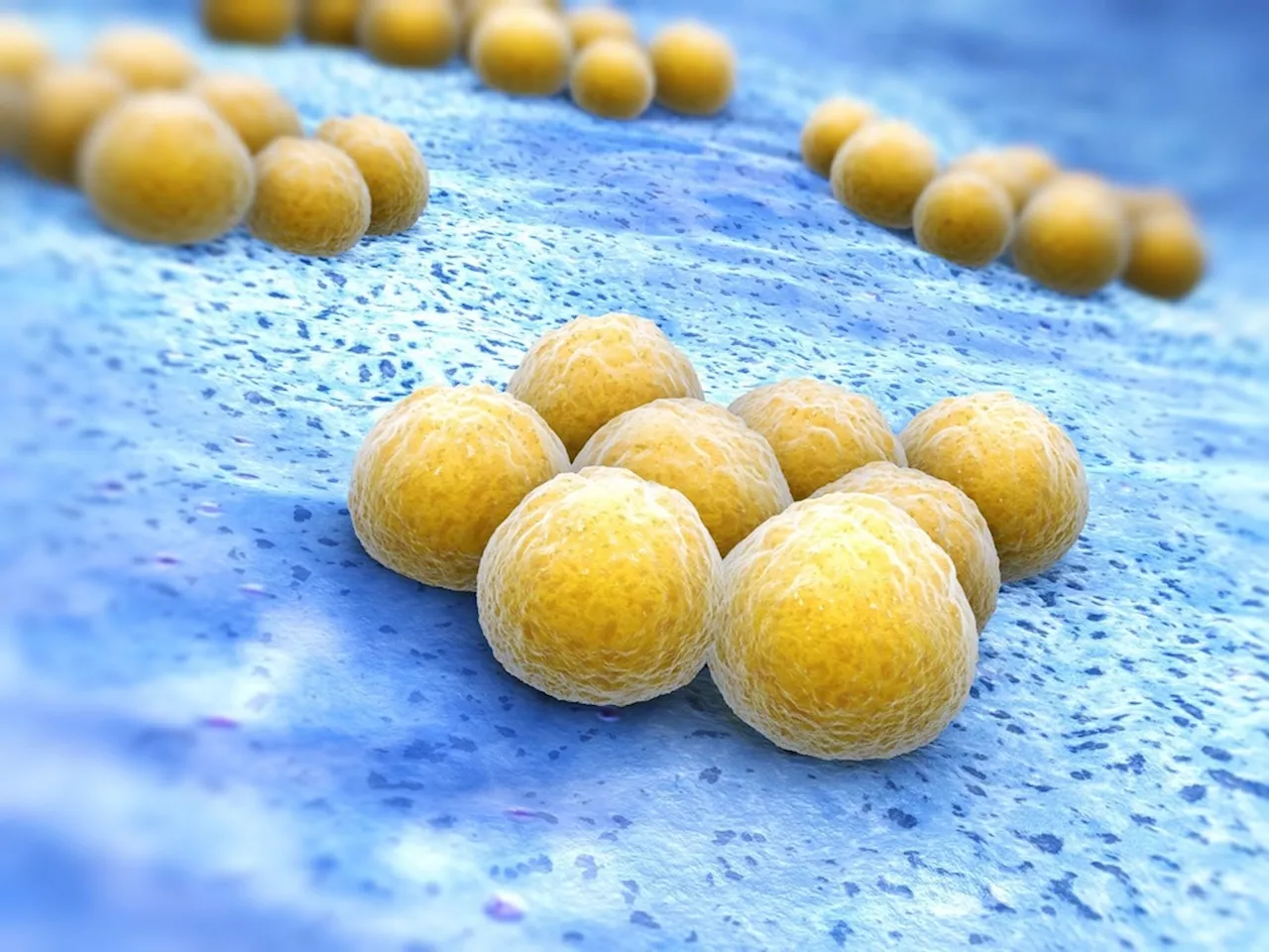 Researchers uncover how deadly MRSA pneumonia inhibits body's antimicrobial activity