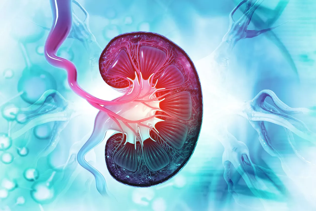 Certain Type 2 Diabetes Drugs Lower Risk of Kidney Stones