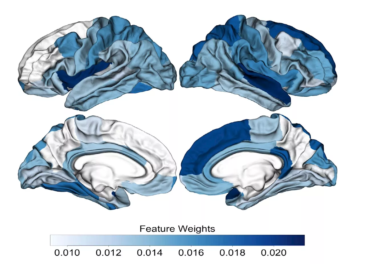 Researchers create machine learning-based classifier that could aid early diagnosis of psychosis