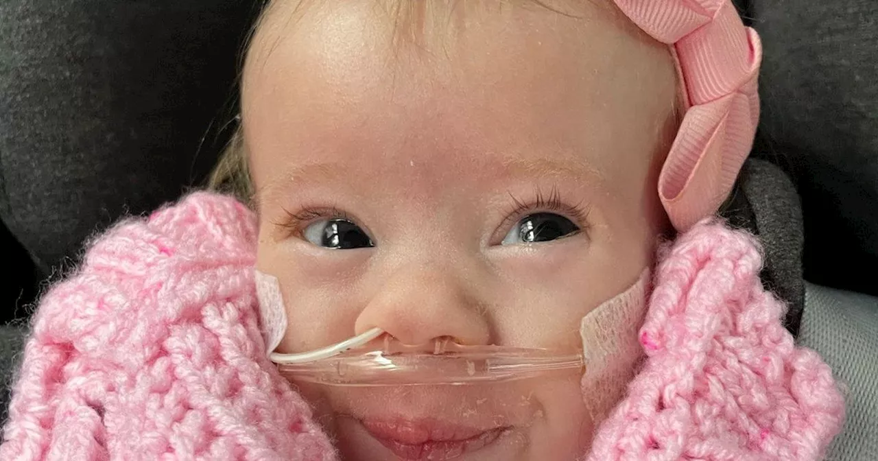 Baby with rare condition born nine weeks early and weighing 1lb 2oz has 'never stopped smiling'