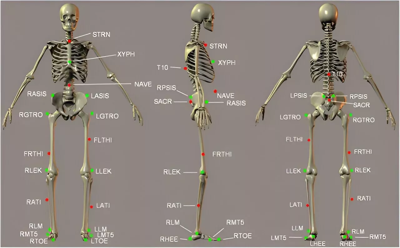 Can a purposeful walk intervention and an activity monitor improve hip replacement patients' daily fitness?