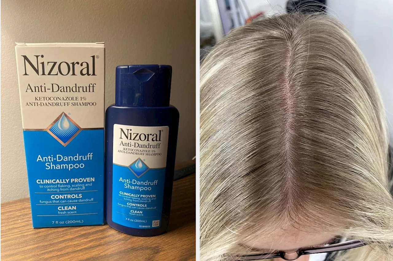 Nizoral Shampoo: $16 Gold Standard For Dandruff Treatment