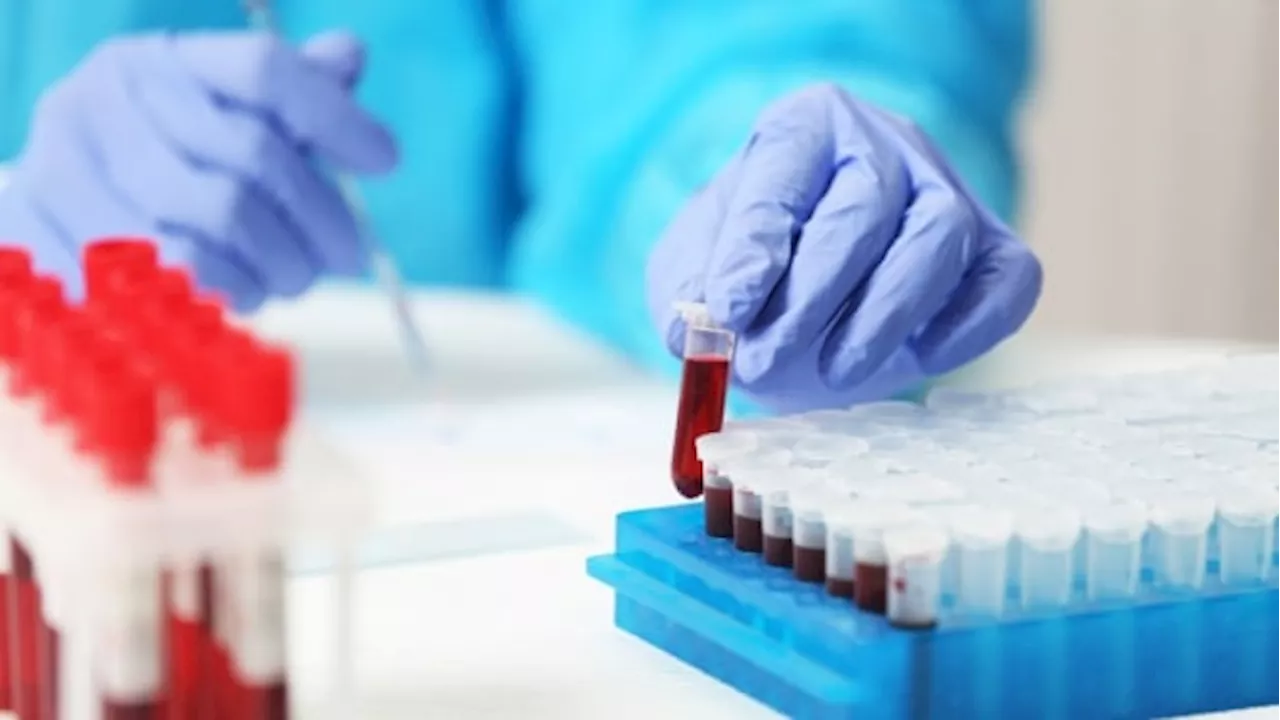 Alberta's Failed Attempt to Privatize Lab Services Comes at a High Cost