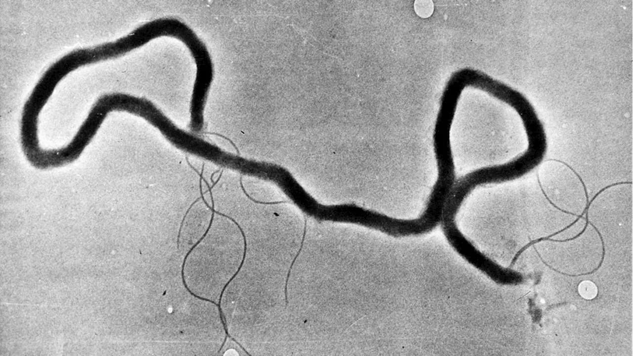 Leeds, Grenville and Lanark health unit concerned over rise in syphilis cases