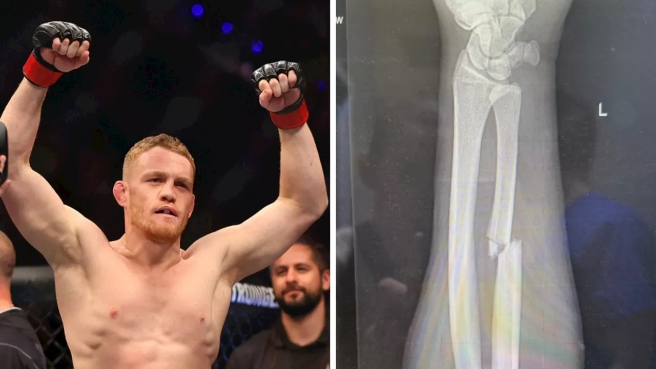 Brutal image reveals stunning truth behind Aussie’s epic UFC statement