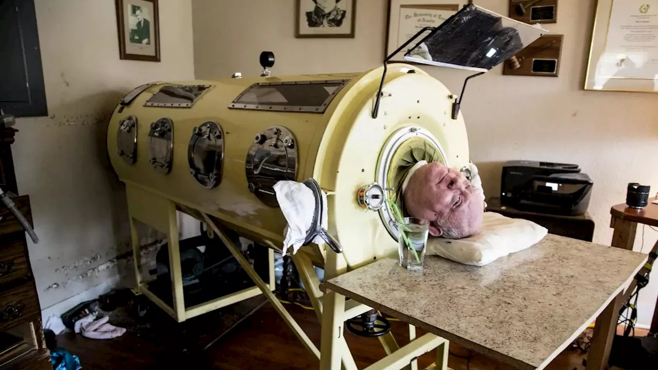 Man in Iron Lung, Paul Alexander, Dies at 78