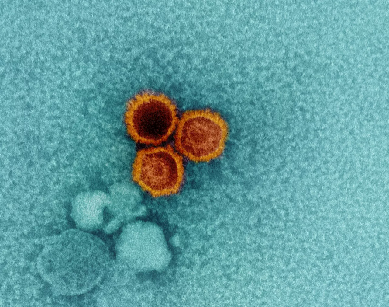 Scientists find weak points on Epstein-Barr virus