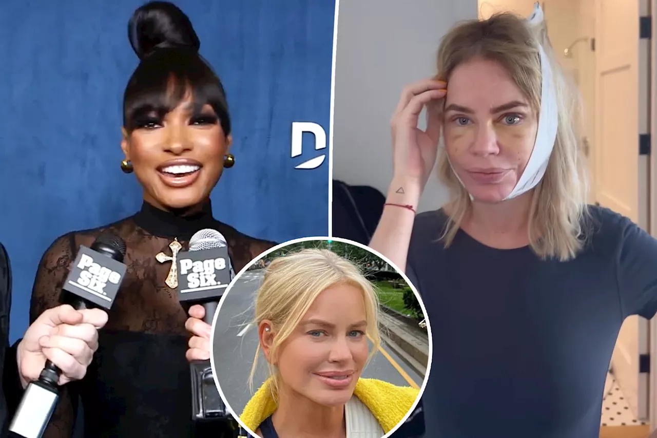 'RHODubai' star Lesa Milan applauds Caroline Stanbury, 47, for 'amazing' facelift: She looks 25