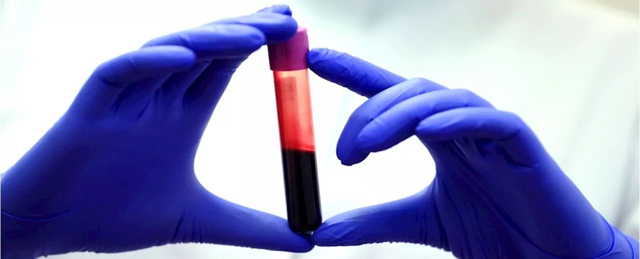 A Blood Test Could Reveal Your Biological Age And Predict Disease Risk