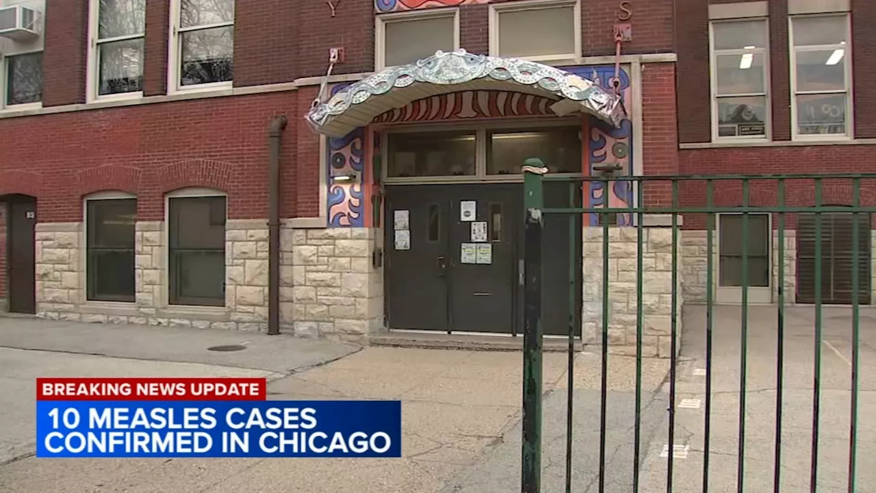 Chicago Measles outbreak spreads to 2 CPS schools; cases rise at Pilsen shelter