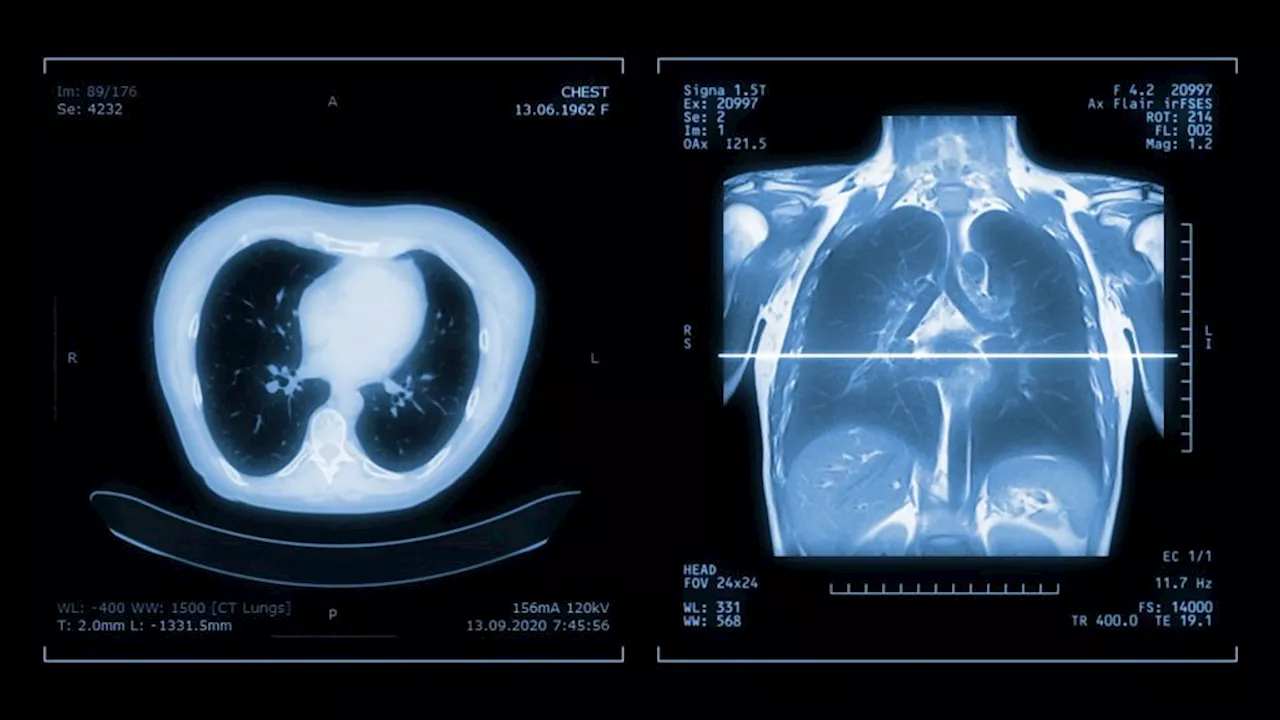 Microplastics Found Deep Inside Human Lungs