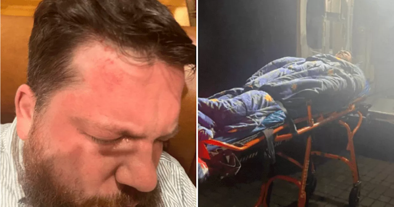 Former Alexei Navalny aide brutally attacked with hammer, blames ‘Putin’s henchmen’