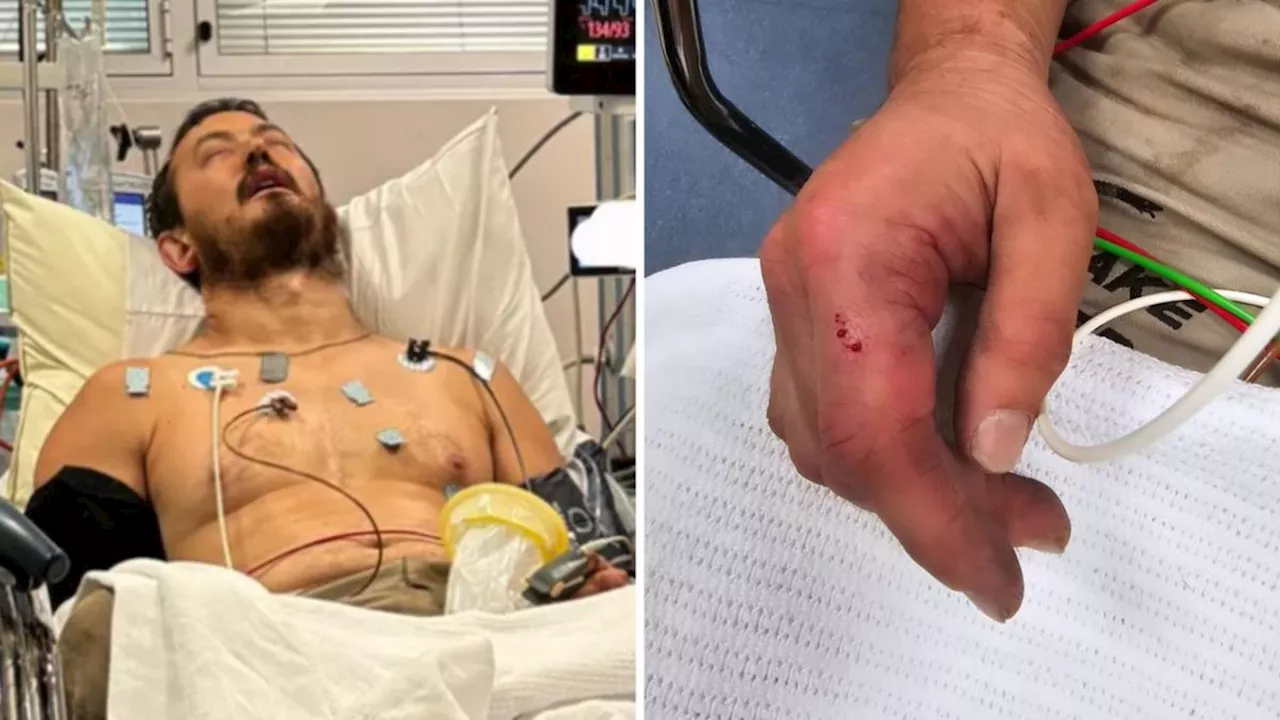 Victorian snake catcher Mark Pelley fighting for life in hospital after tiger snake bite