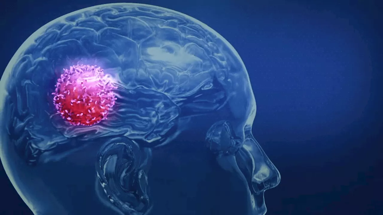 New strategy to attack aggressive brain cancer shrank tumors in 2 early tests