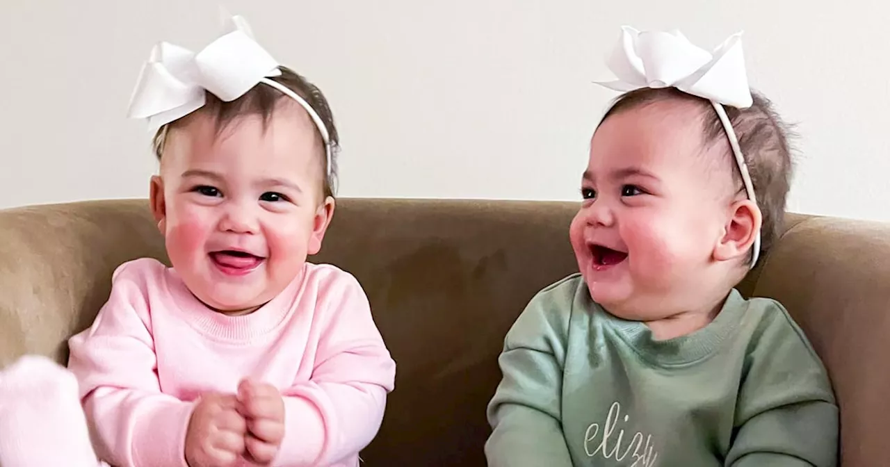 Formerly Conjoined Fuller Twins Celebrate 1st Birthday