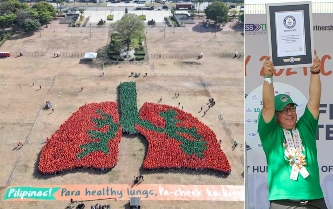 PH sets new world record: Largest lung formation