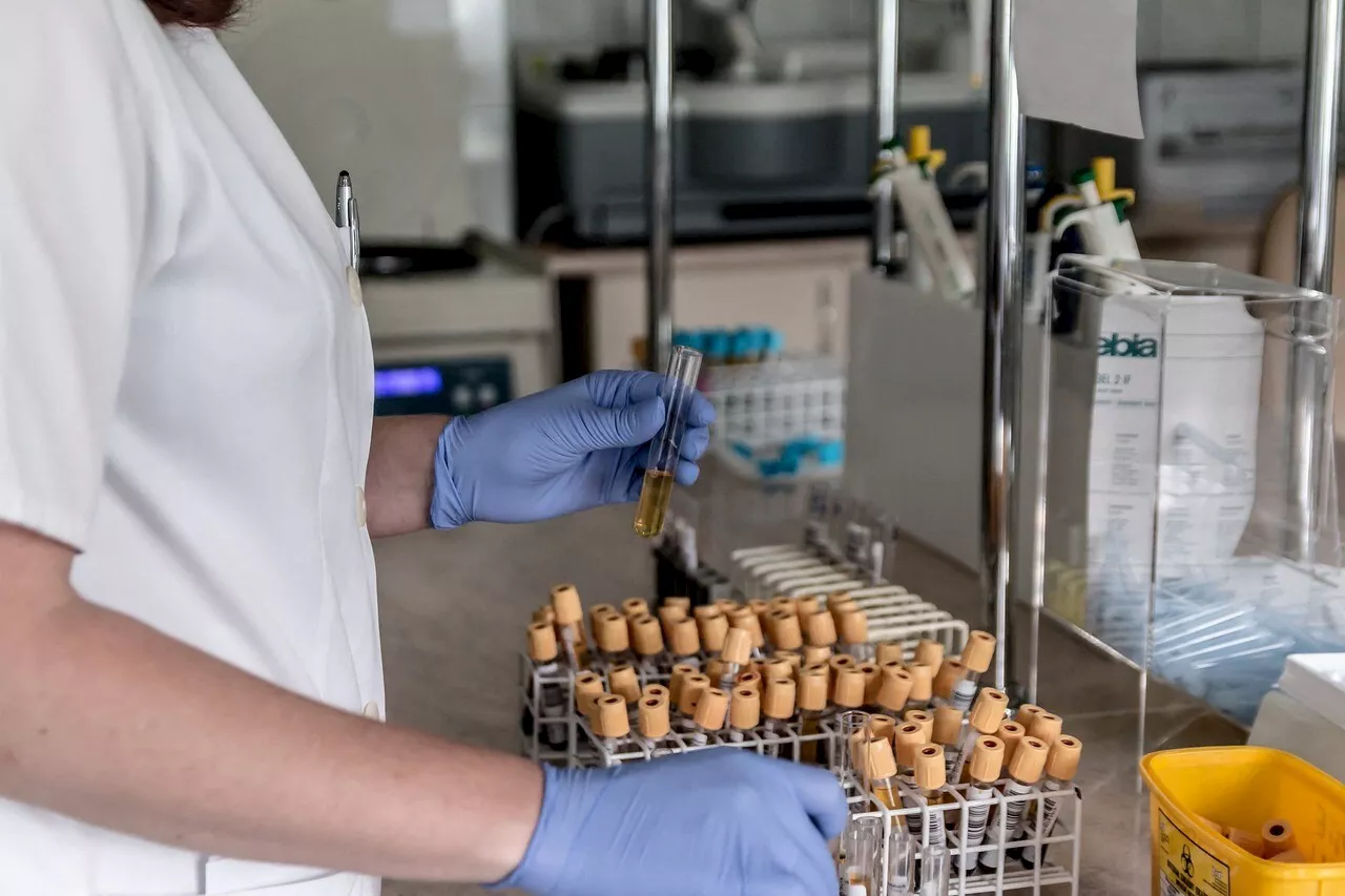 Sida, hépatite, syphilis : 'Une population informée est une population qui prend soin de sa santé'