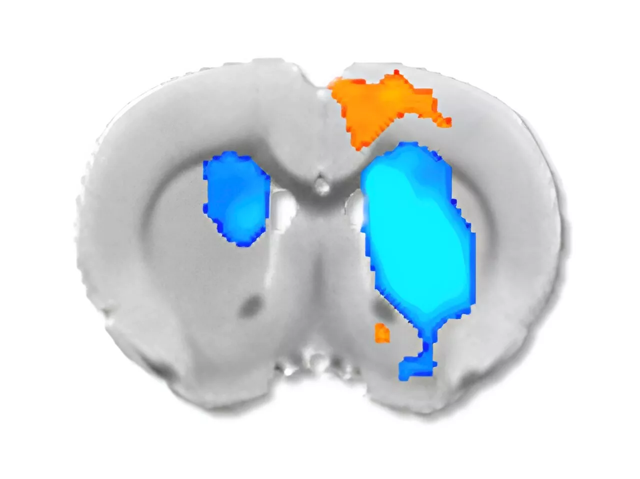 A new study shows how neurochemicals affect fMRI readings