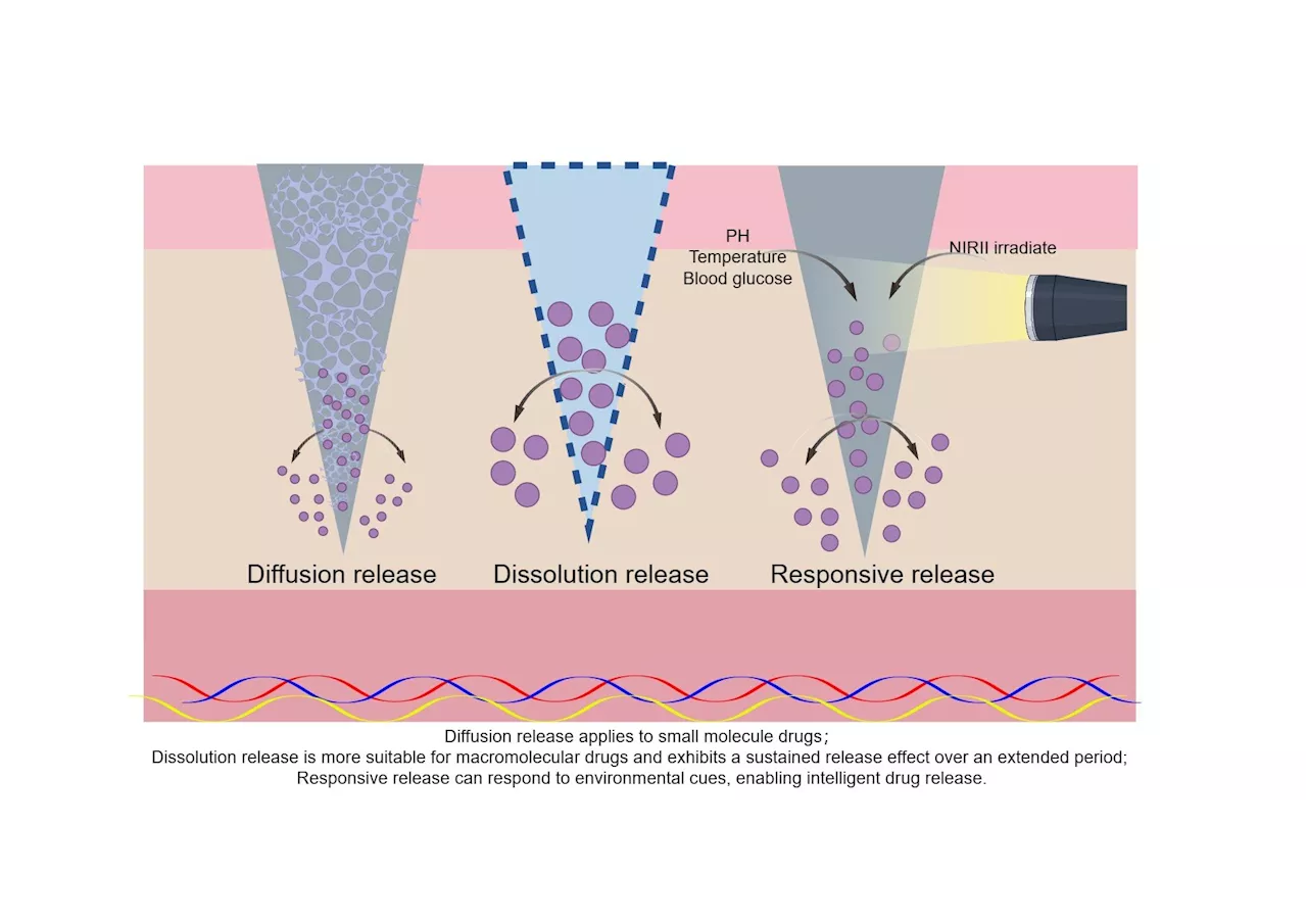 Promoting diabetic wound healing using microneedles