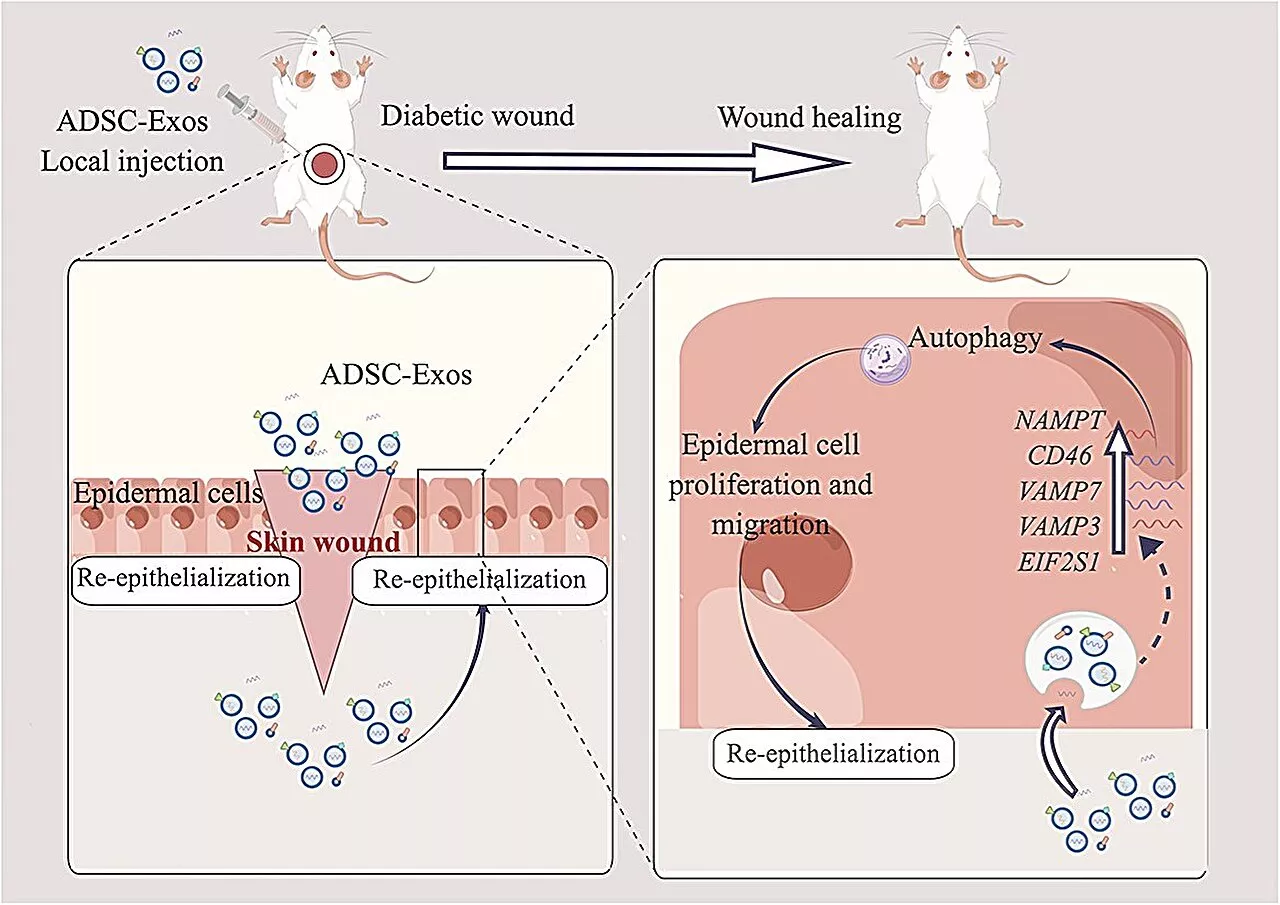 Stem cell 'messages' fast-track healing of diabetic wounds