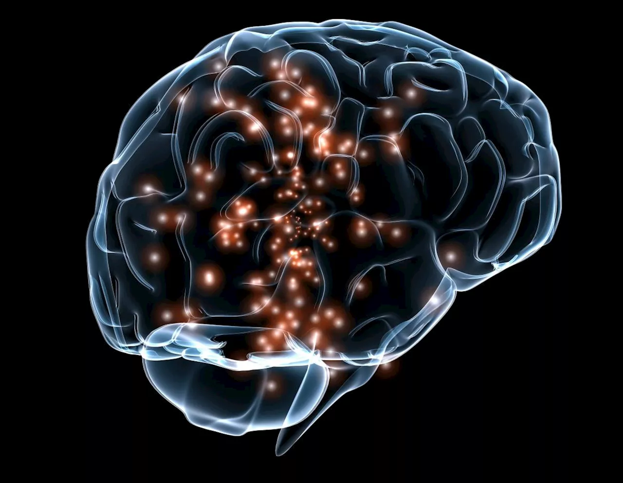 Study shows glucose levels affect cognitive performance in people with type 1 diabetes differently