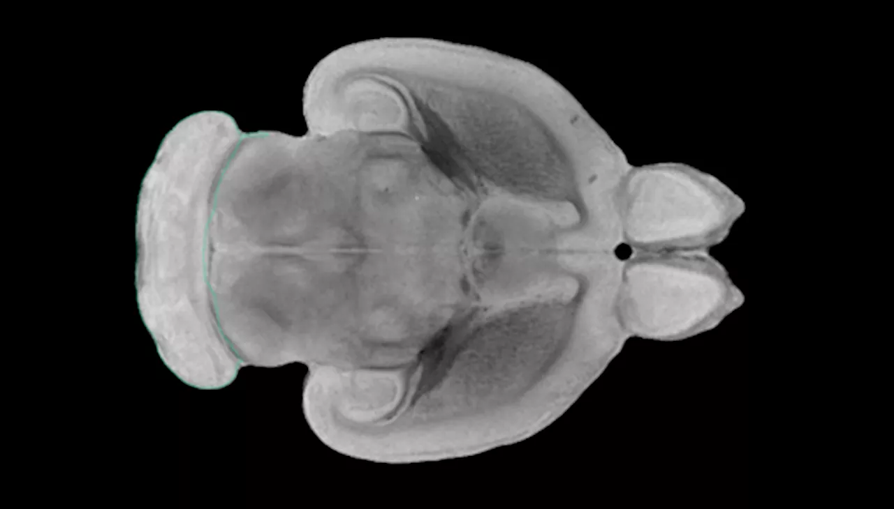 Transcriptomic analysis of rat brain response to alternating current electrical stimulation