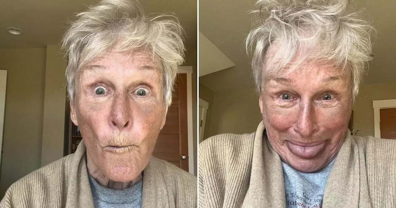 Hollywood legend, 76, shocks fans with bruised face in new selfie