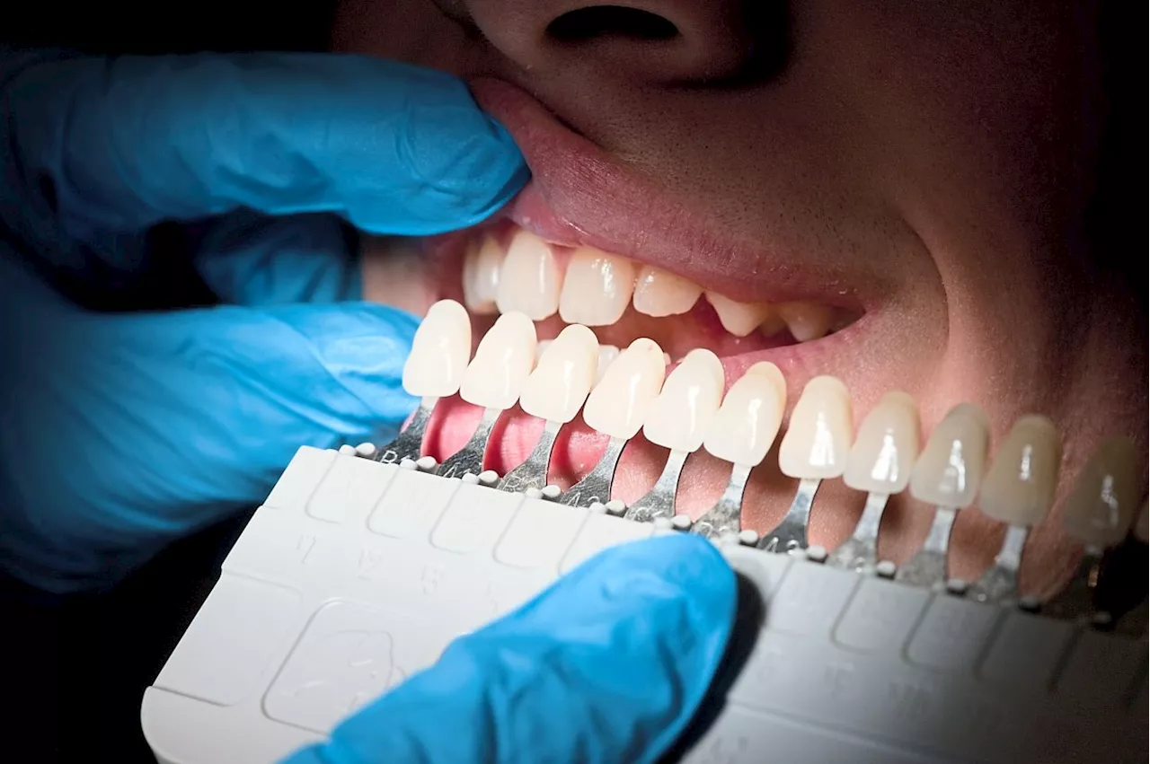 QuickCheck: Is dental treatment tax deductible in 2023?