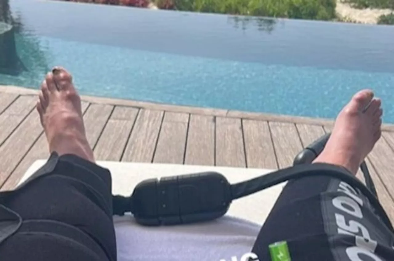 Fans notice Cristiano Ronaldo’s swollen and bruised feet in Instagram post...