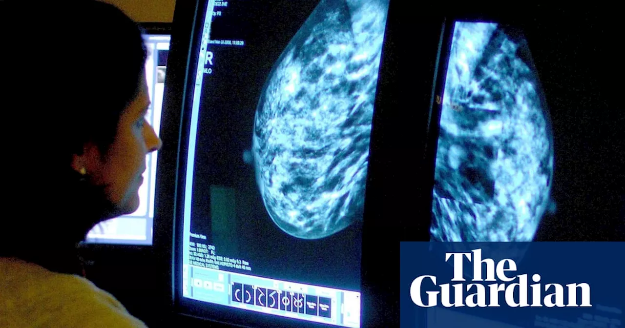 Breast cancer drug may help thousands more women than previously thought