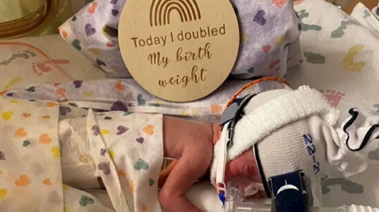 Premature 'miracle baby' born in Portland weighed only 14 ounces