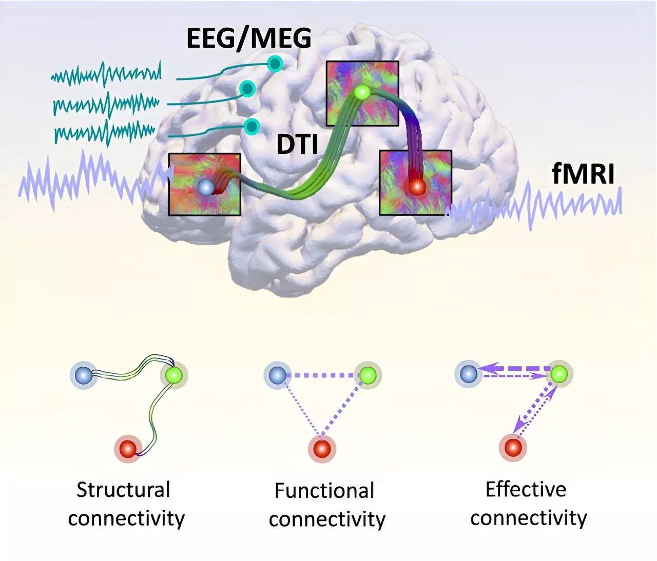 Unlocking Alzheimer's mysteries: A comprehensive brain connectome-based survey