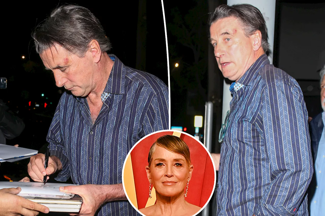 Billy Baldwin steps out with mysterious head abrasion after feuding with Sharon Stone