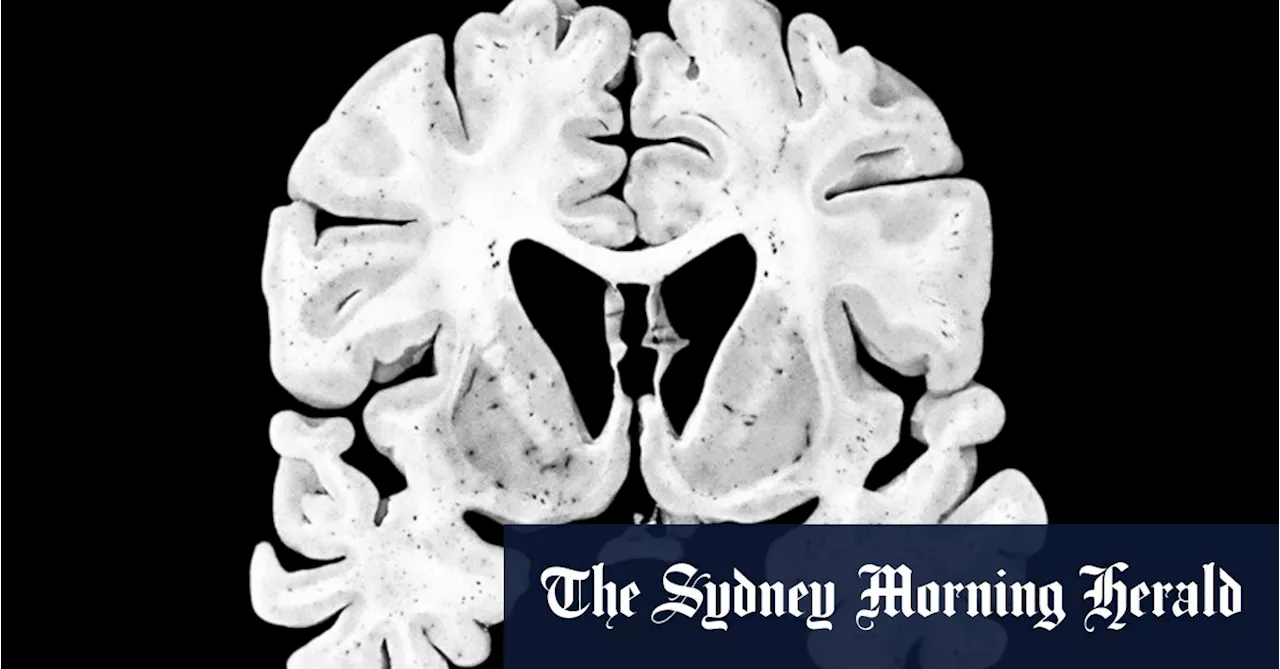 The seven conditions found in former footy players’ brains