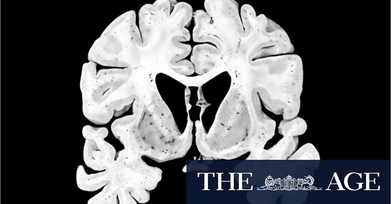 The seven conditions found in former footy players’ brains