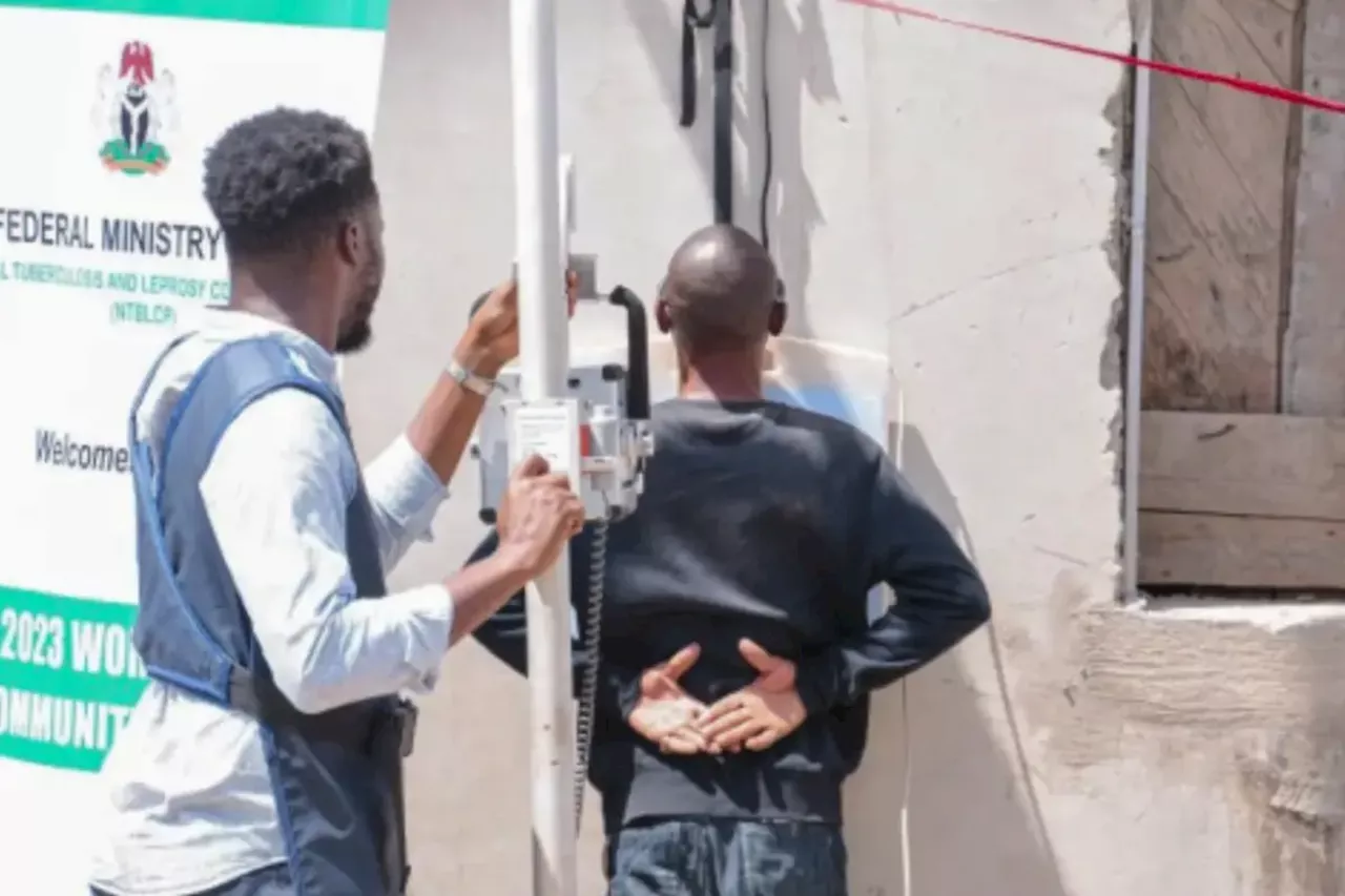 Advocate Calls for Protection of Rights of Tuberculosis Survivors