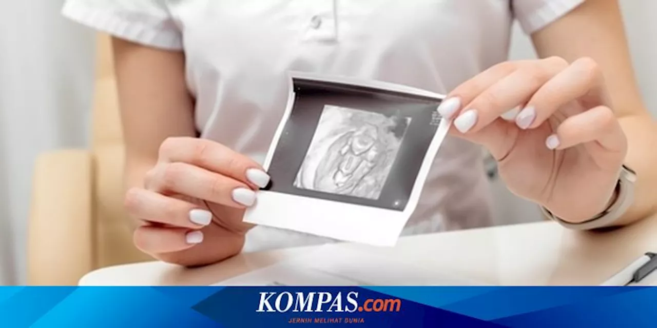 Ramai soal Makanan Tinggi Estrogen Disebut Bisa Sebabkan Kista, Ini Kata Dokter