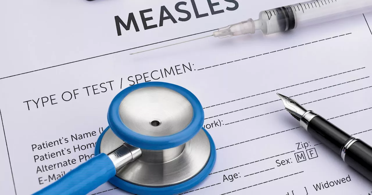 Possible measles exposure at San Leandro restaurant prompts warning from Alameda County