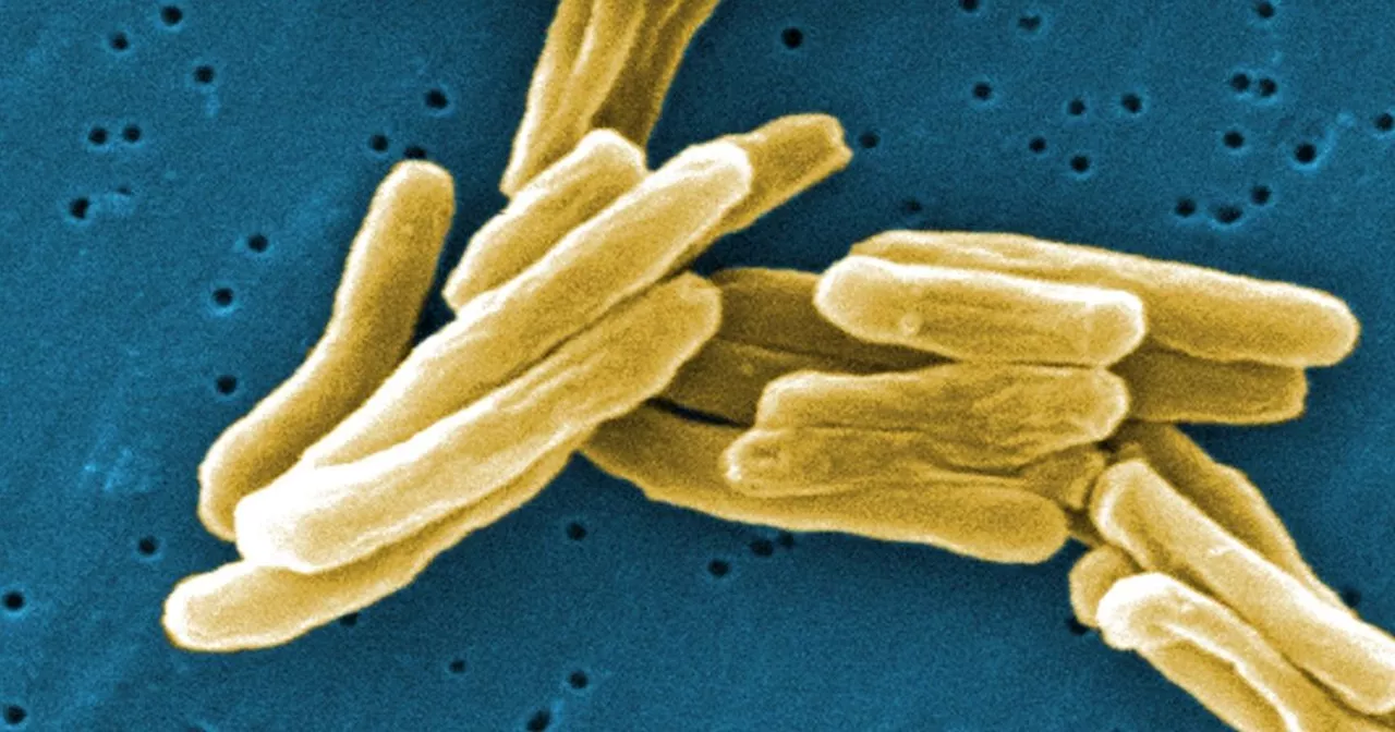 The Victorian superbug that's on the rise across the UK