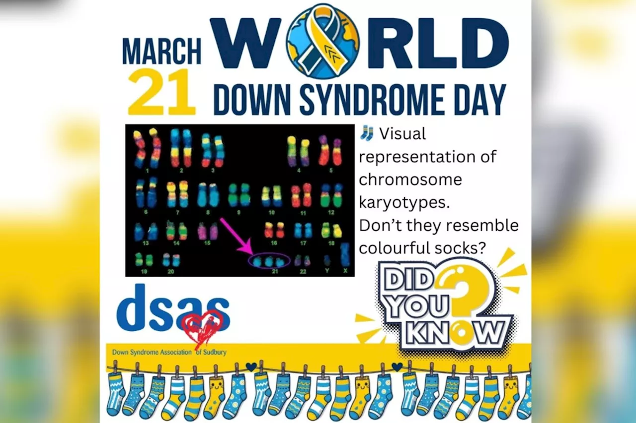 Wear mismatched socks to celebrate Down syndrome day March 21