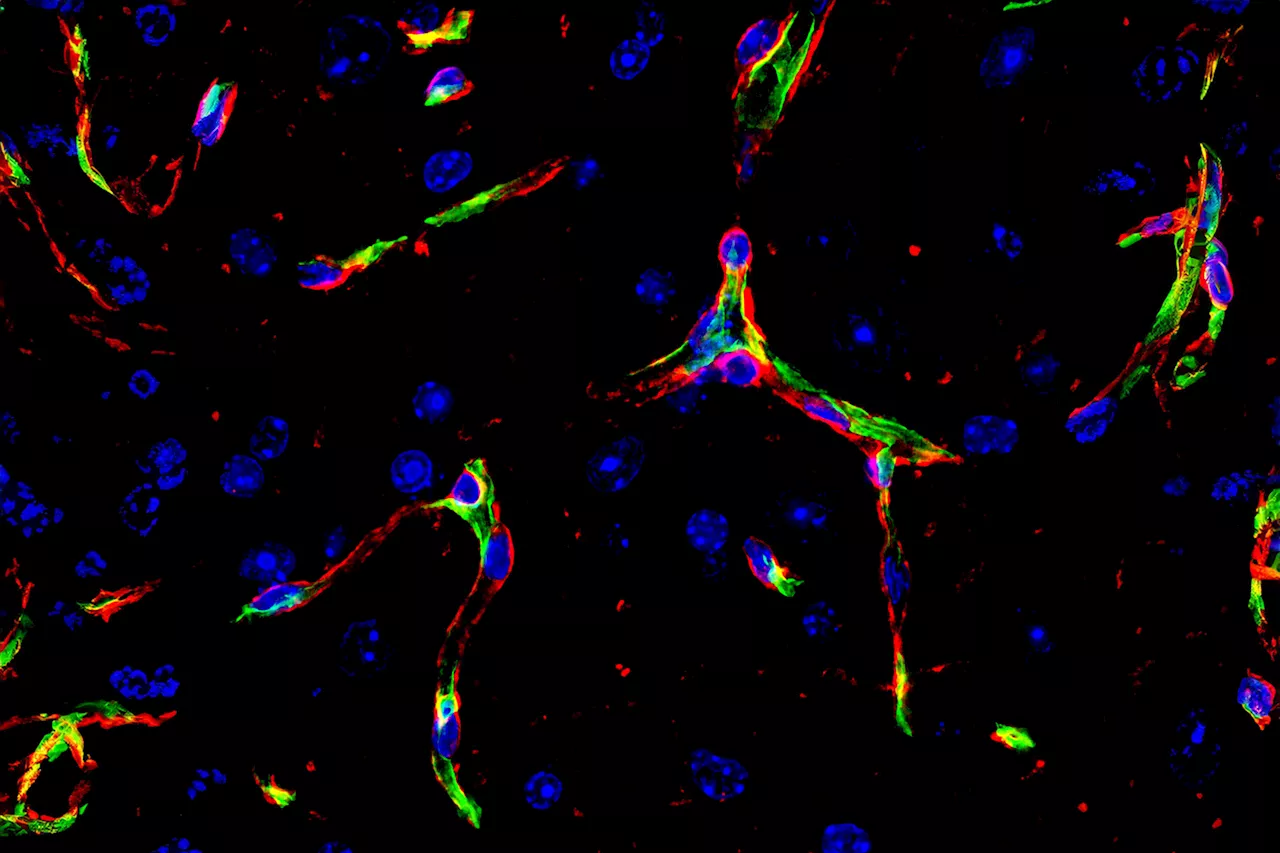 Research offers hope for preventing post-COVID 'brain fog' by targeting brain's blood vessels