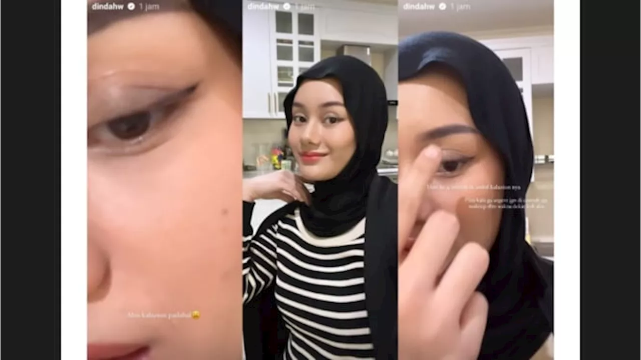 Artis Cantik Dinda Hauw Alami Kalazion, Matanya Harus Diperban!