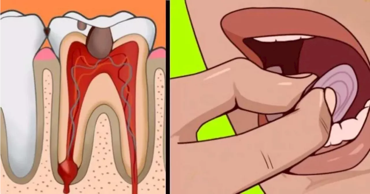 9 Effective Home Remedies for Toothache Pain Relief