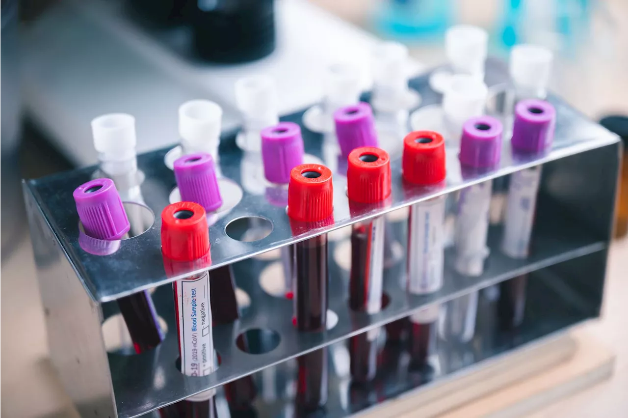 New Blood Test for Colorectal Cancer Shows Promise in Early Detection, Study Finds