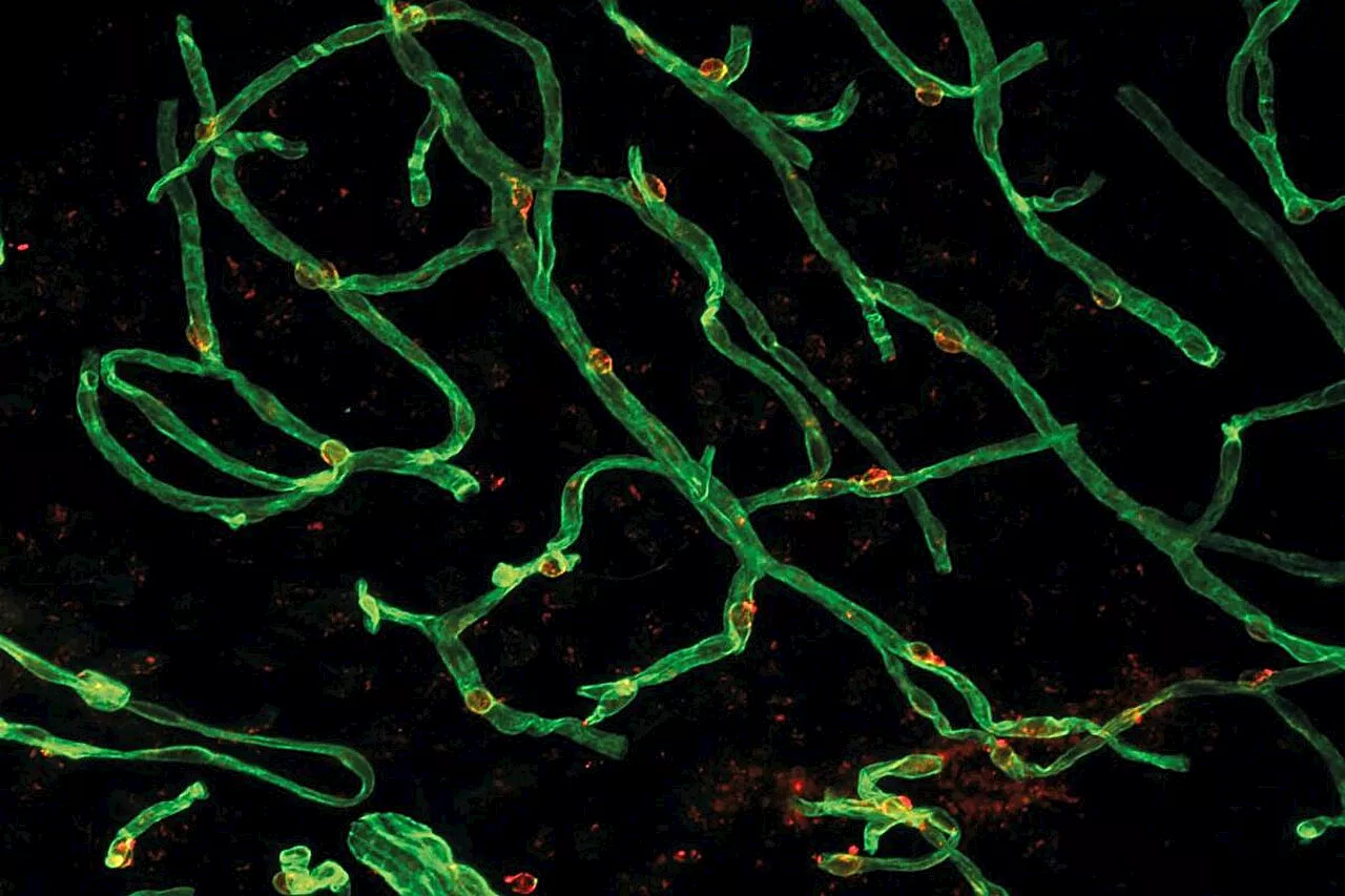 Researchers analyze how the proteome of specific brain cells changes as we age