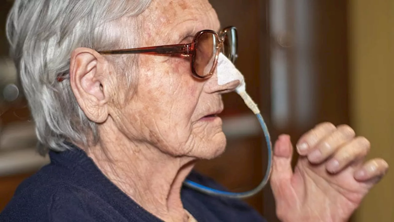 Sarcopenia May Predict Feeding Tube Placement in Patients With OPSCC